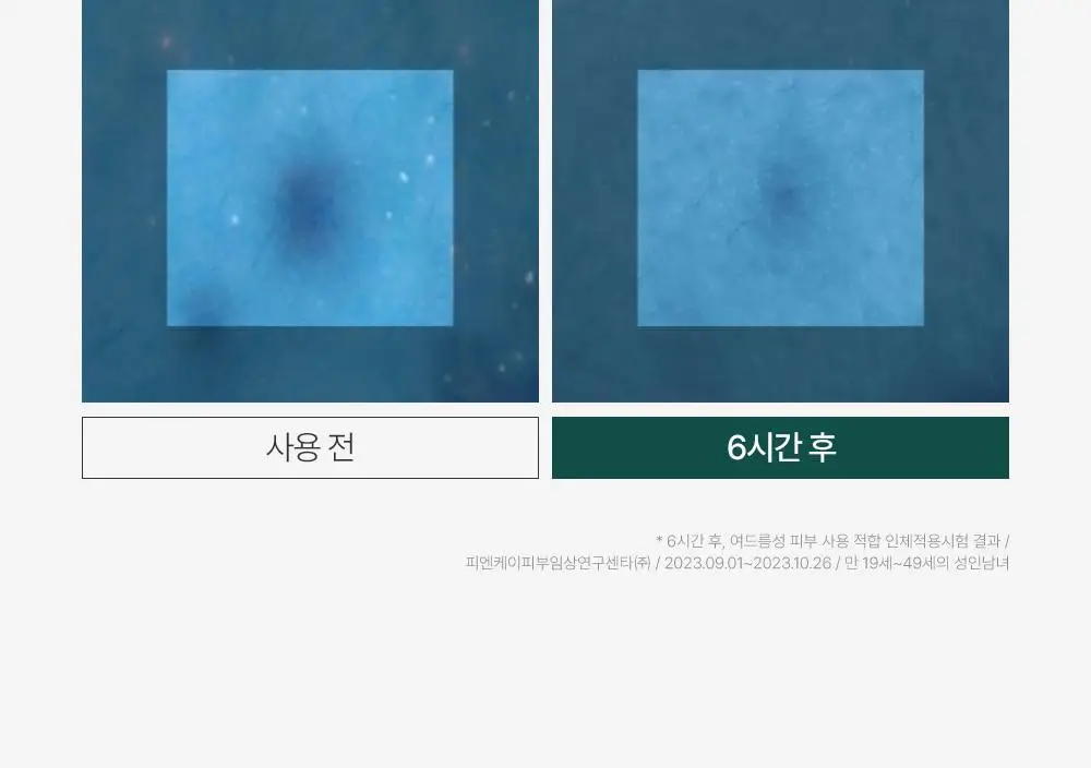 [트러블부위 진정케어] 피캄 센텔라 트러블 스팟 15ml 상세페이지 15